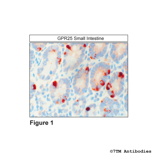 GPR25 (IHC-grade), G Protein-Coupled Receptor 25 Antibody