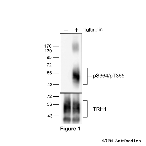 Agonist-induced Serine364/Threonine365 phosphorylation of the TRH1-Receptor