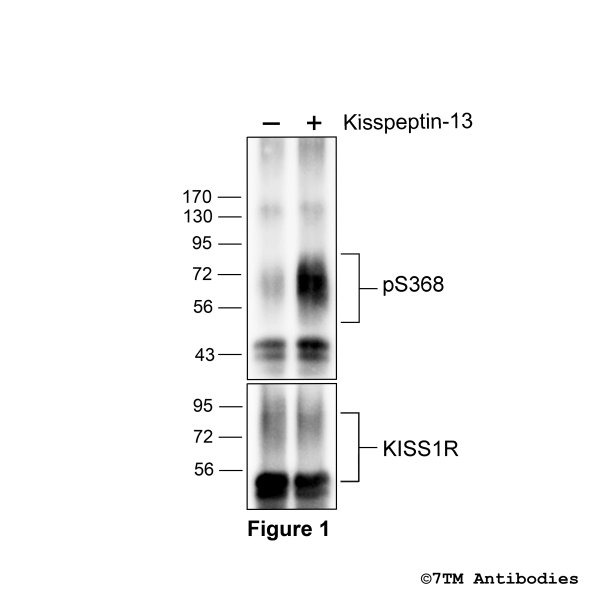 pS368-KISS1R (phospho-Kisspeptin Receptor Antibody)