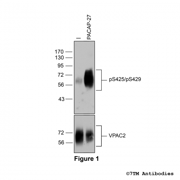 pS425/pS429-VPAC2 (phospho-VIP Receptor 2 Antibody)