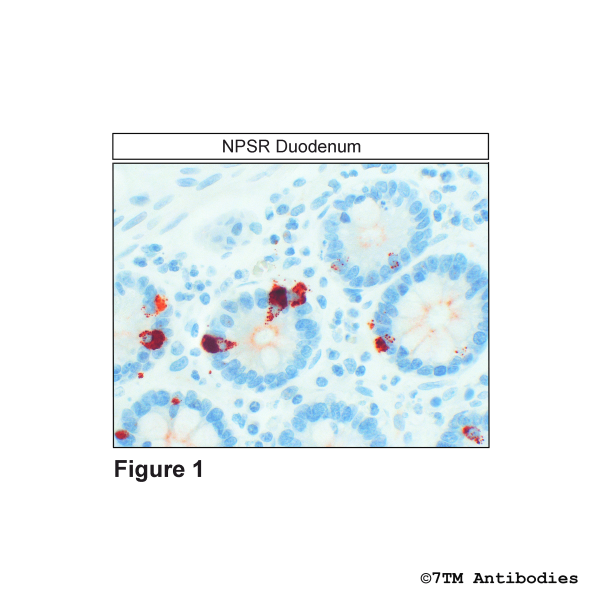  Immunohistochemical identification of NPSR in Duodenum