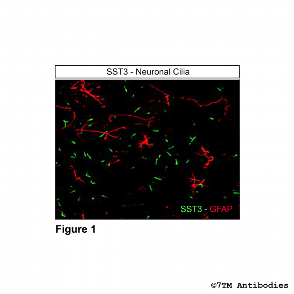 Immunohistochemical identification of Somatostatin Receptor 3 in neuronal cilia.