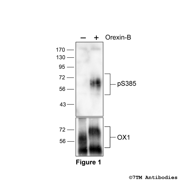 Agonist-induced Serine385 phosphorylation of Orexin Receptor 1