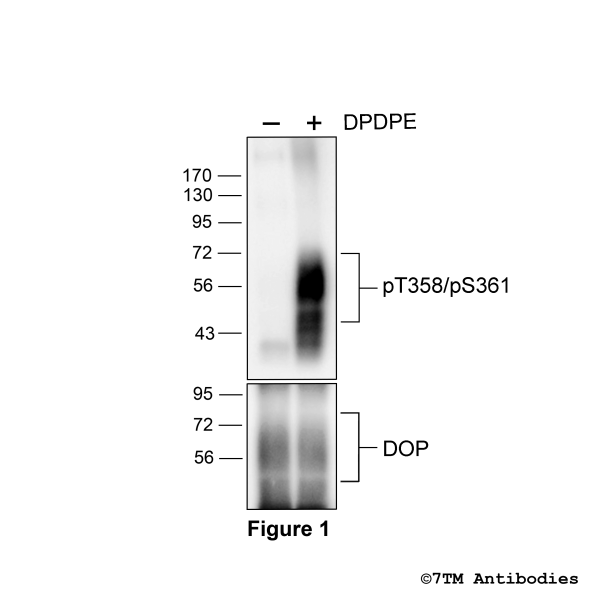 Agonist-induced Threonine358/Threonrine361 phosphorylation of the δ-Opioid receptor