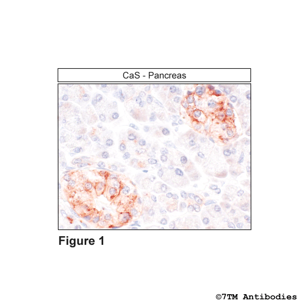  Immunohistochemical identification of Calcium-sensing Receptor in pancreas