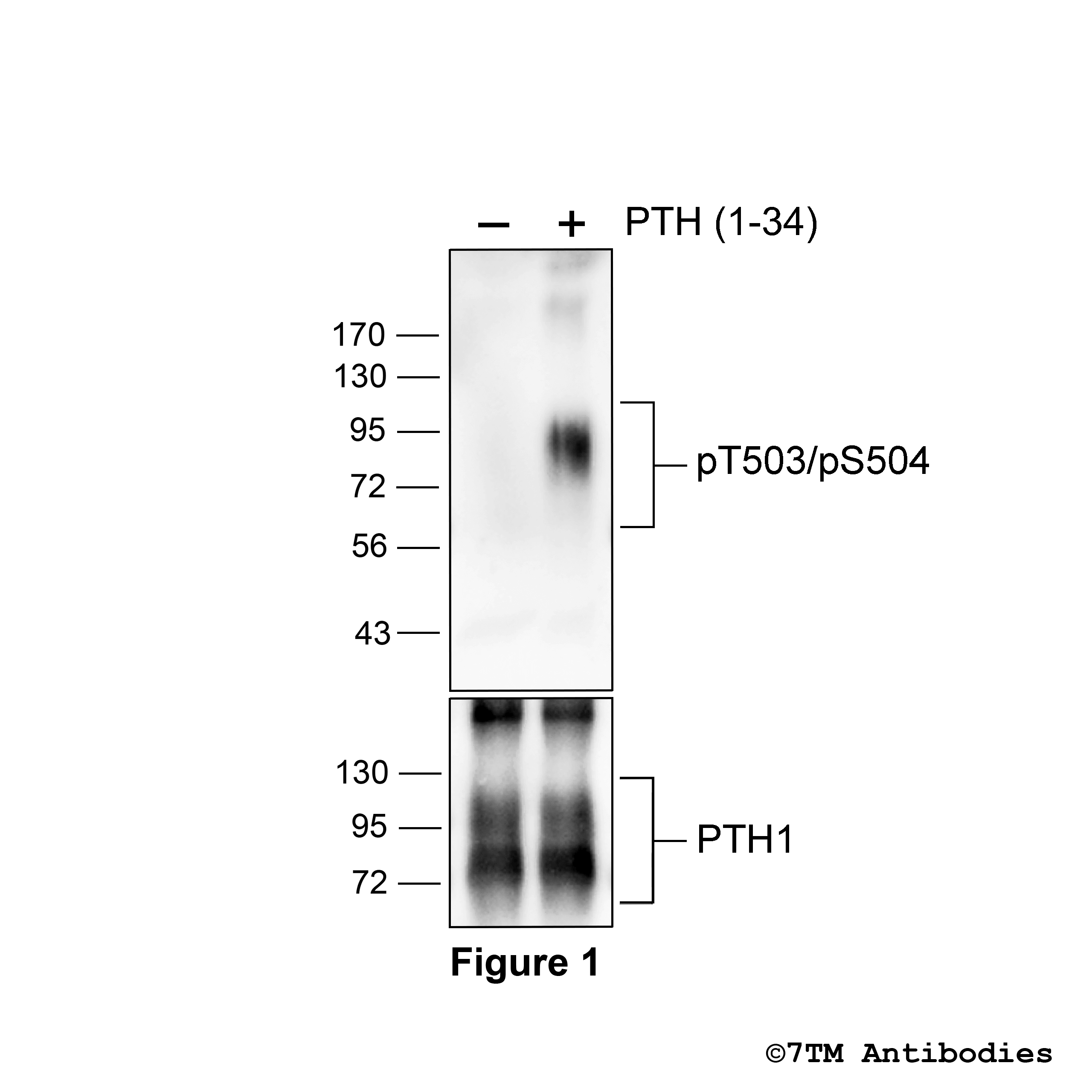 Parathyroid Hormone Receptors PTH 7TM Antibodies®