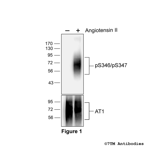 Agonist-induced Serine346/Serine347 phosphorylation of the Angiotensin Receptor 1