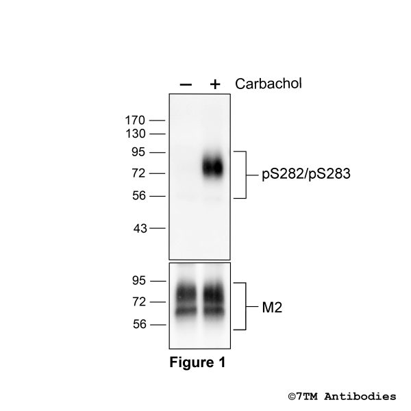 Agonist-induced Serine282/Serine283 phosphorylation of the M2 Muscarinic Acetylcholine Receptor