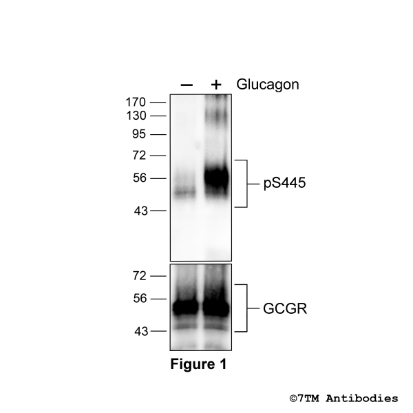 Agonist-induced Serine445 phosphorylation of Glucagon Receptor