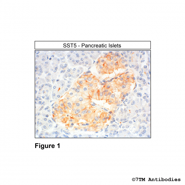 Immunohistochemical identification of Somatostatin Receptor 5 in human pancreatic islets