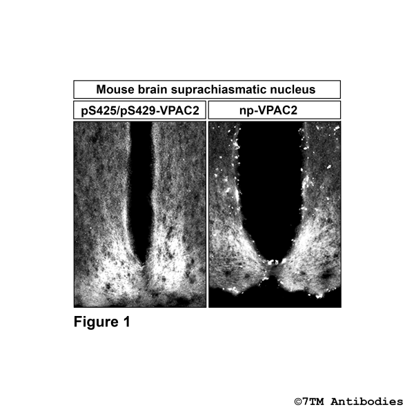 Immunohistochemical identification of Serine 425/Serine429 phosphorylation of VPAC2 Receptor in mouse brain suprachiasmatic nucleus.