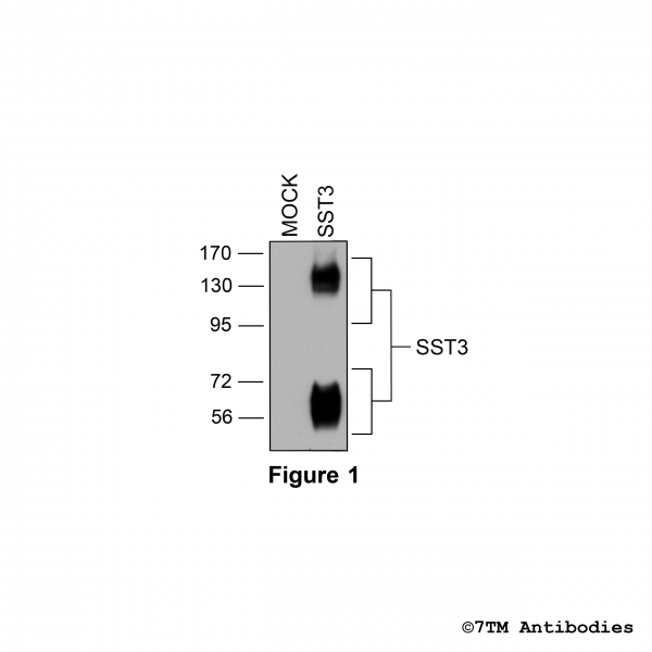 Validation of the Somatostatin Receptor 3 in transfected HEK293 cells.