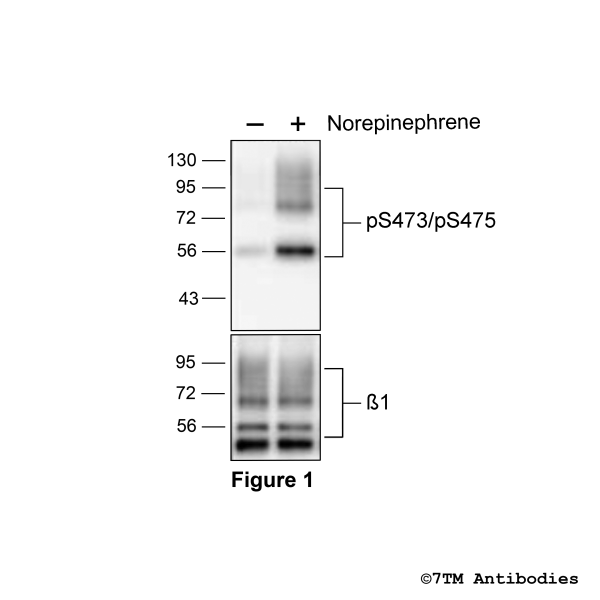  Agonist-induced Serine473/Serine475 phosphorylation of the β1-Adrenoceptor