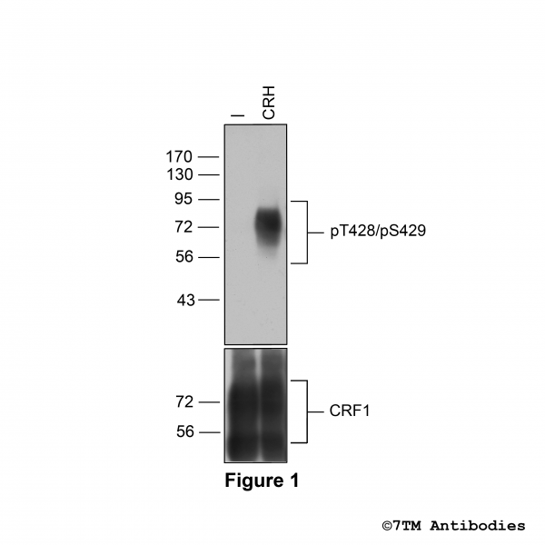 Agonist-induced Threonine428/Serine429 phosphorylation of CRF1 Receptor
