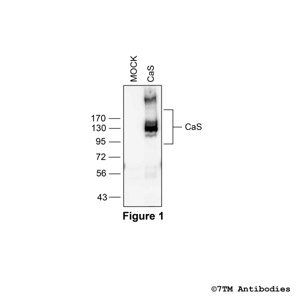 Validation of the Calcium-sensing Receptor in transfected HEK293 cells