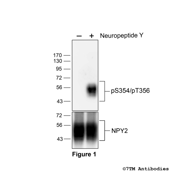 Agonist-induced Serine354/Threonine356 phosphorylation of the Neuropeptide Y receptor 2