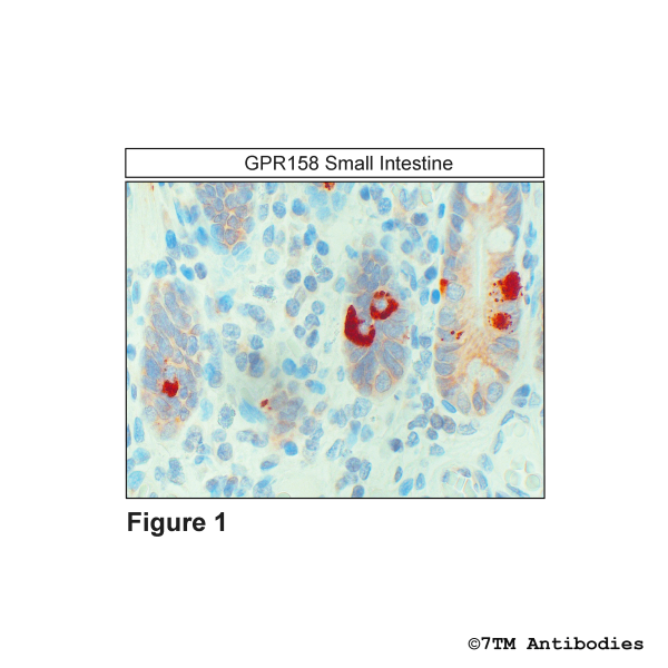 GPR158/GlyR (IHC-grade), Glycin Receptor Antibody