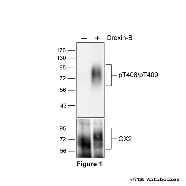 Agonist-induced Threonine408/Threonine409 phosphorylation of Orexin Receptor 2