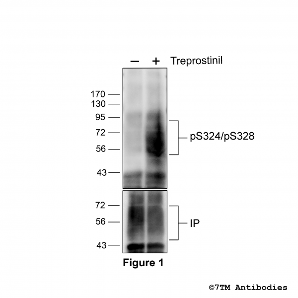 Agonist-induced Serine324/Serine328 phosphorylation of the IP Prostacyclin Receptor