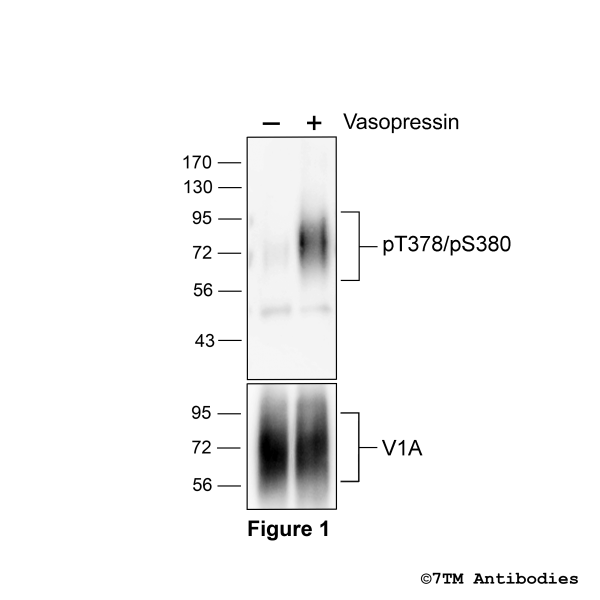 Agonist-induced Threonine378/Serine380 phosphorylation of the Vasopressin Receptor 1A