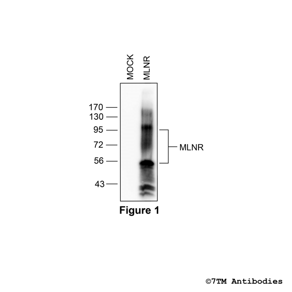 Validation of the Motilin Receptor in transfected HEK293 cells