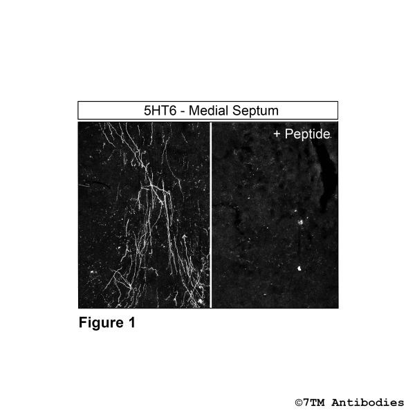  Immunohistochemical varification of 5-Hydroxytryptamine Receptor 6 antibody in Medial Septum