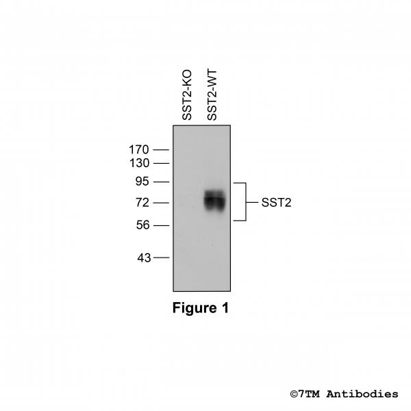 Western blot analysis of Somatostatin Receptor 2 in mouse brain in vivo.