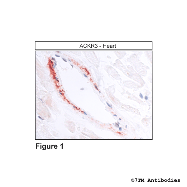  Immunohistochemical identification of Atypical Chemokine Receptor 3 in Heart