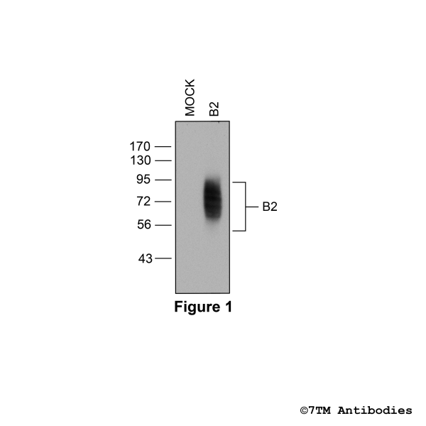 Validation of the Bradykinin Receptor 2 in transfected HEK293 cells