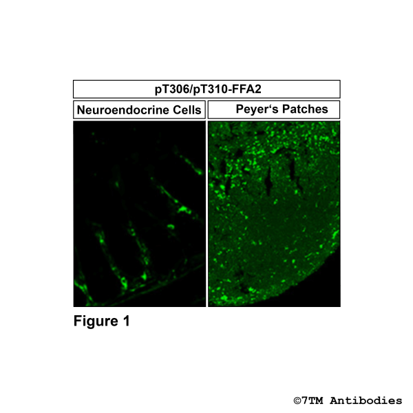 Immunohistochemical Identification of Threonine306/Threonine310 phosphorylation of the FFA Receptor 2 in mouse neuroendocrine cells and peyer's patches. 