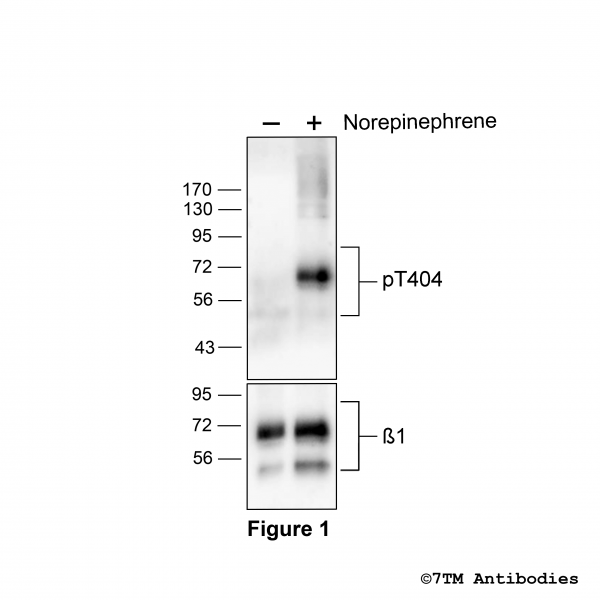 Agonist-induced Threonine404 phosphorylation of the β1-Adrenoceptor