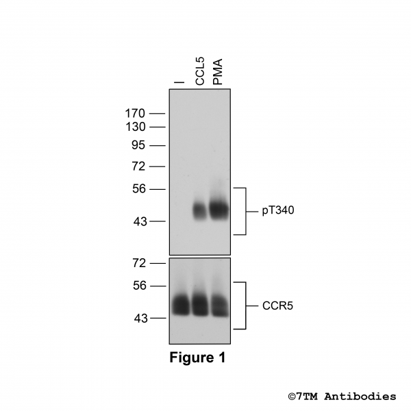 Agonist-induced Threonine340 phosphorylation of the Chemokine Receptor 5