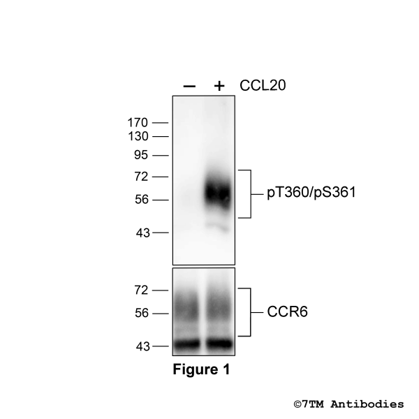 pT360/pS361-CCR6 (phospho-Chemokine Receptor 6 Antibody)