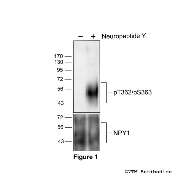 Agonist-induced Threonine362/Serine363 phosphorylation of the Neuropeptide Y receptor 1