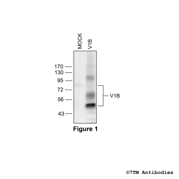  Validation of the Vasopressin Receptor 1B in transfected HEK293 cells.