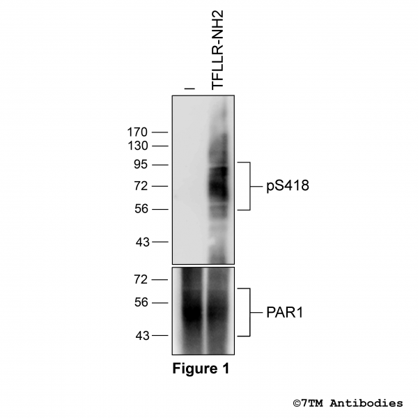 Agonist-induced Serine418 phosphorylation of the Proteinase-Activated Receptor 1