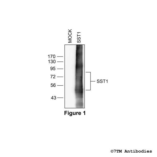 SST1 (non-phospho-Somatostatin Receptor 1 Antibody)