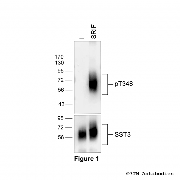 pT348-SST3 (phospho-Somatostatin Receptor 3 Antibody)
