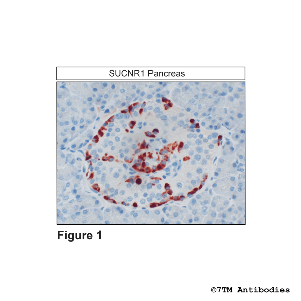 SUCNR1/GPR91 (IHC-grade), Succinate Receptor Antibody