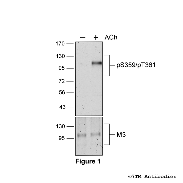 Agonist-induced Serine359/Threonine361 phosphorylation of the M3 Muscarinic Acetylcholine Receptor