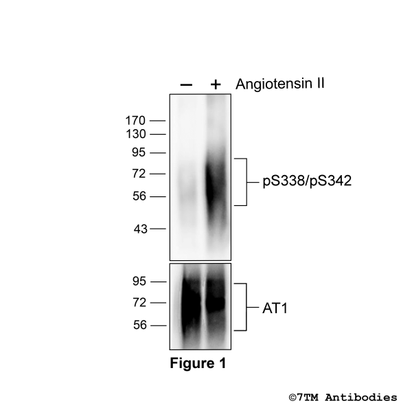 Agonist-induced Serine338/Serine342 phosphorylation of the Angiotensin Receptor 1