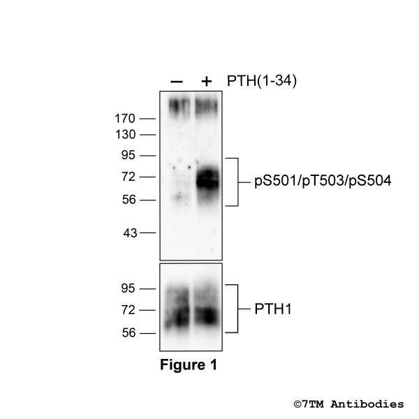 Agonist-induced Serine501/Threonine503/Serine504 phosphorylation of the Parathyroid Hormone Receptor 1