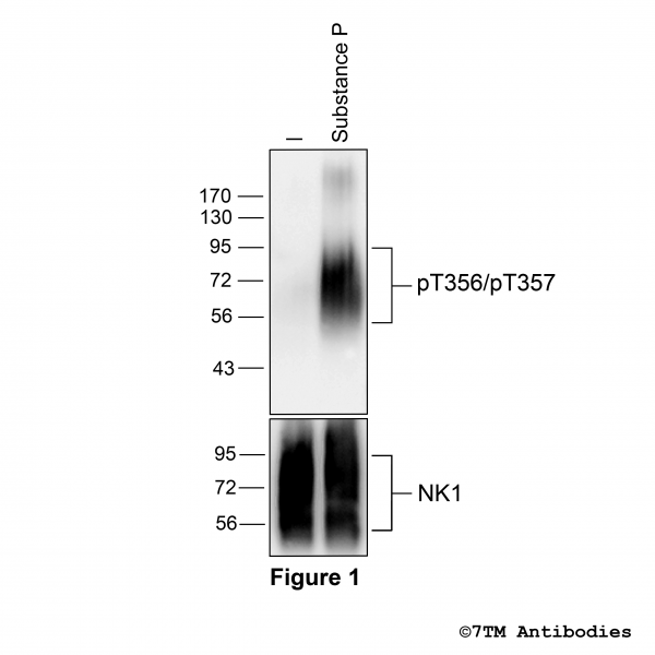 Agonist-induced Threonine356/Threonine357 phosphorylation of NK1 Receptor
