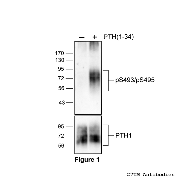 pS493/pS495-PTH1 (phospho-Parathyroid Hormone Receptor 1 Antibody)
