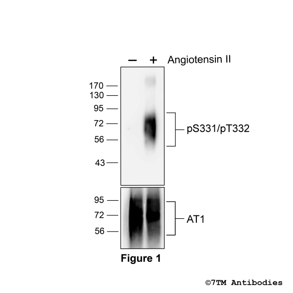 Agonist-induced Serine331/Threonine332 phosphorylation of the Angiotensin Receptor 1