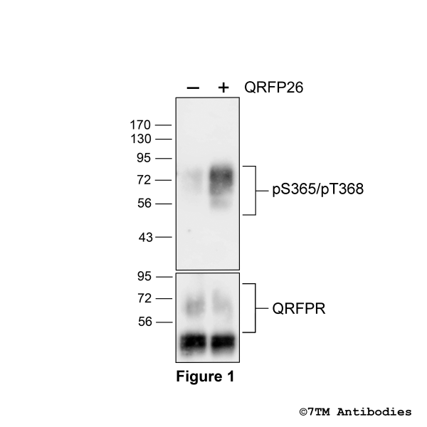 Agonist-induced Serine365/Threonine368 phosphorylation of QRFP Receptor