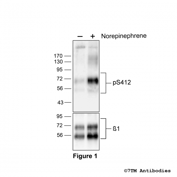 Agonist-induced Serine412 phosphorylation of the β1-Adrenoceptor