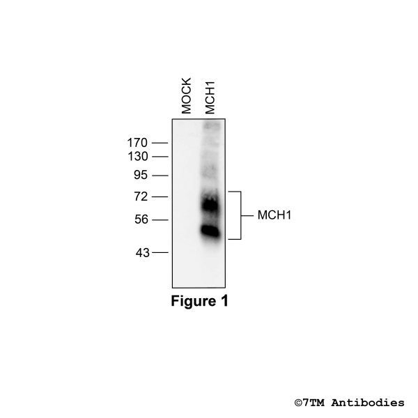 Validation of the Melanin-Concentrating Hormone Receptor 1 in transfected HEK293 cells