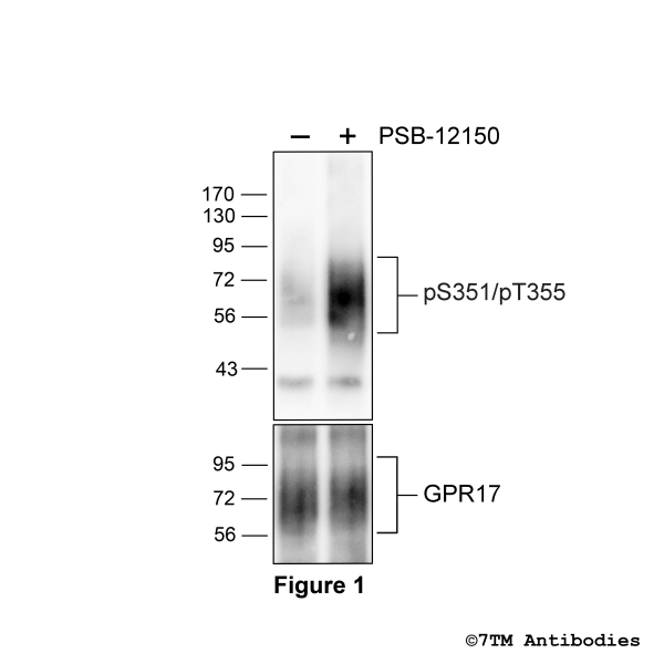 pS351/pT356-GPR17 (phospho-GPR17 Antibody)