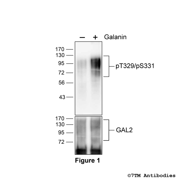 Agonist-induced Threonine329/Serine331 phosphorylation of GAL2 Receptor